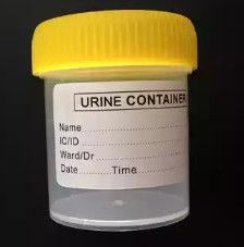 CAD / UG Custom Medical Injection Mold Urine Collector Mould OEM